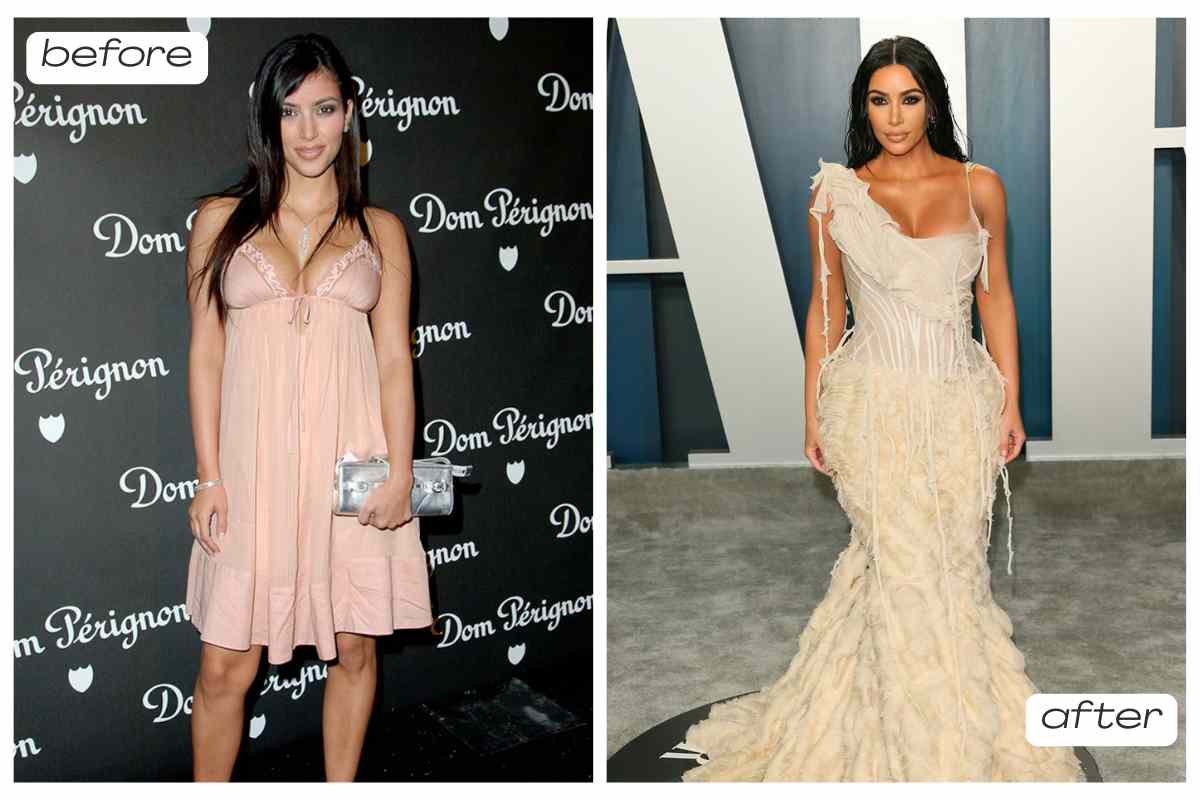 kim kardashian before and after plastic surgery